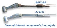 Before and After Hayes Handpiece Surgical dental Handpieces California
