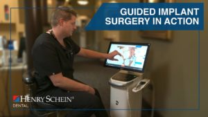 Guided Implant Surgery in Action